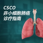 癌症有指南-中国临床肿瘤学会CSCO（2021）非小细胞肺癌诊疗指南